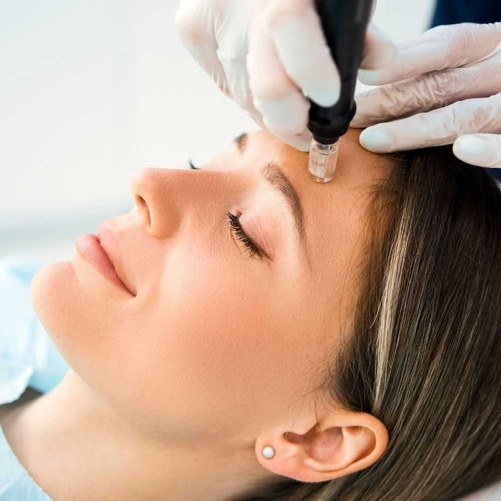 Woman receiving a facial treatment with a derma pen.